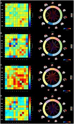 Abnormal dynamic functional network connectivity in patients with early-onset bipolar disorder